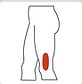 Icon showing the area on leg where Illiotibial Band Syndrome is common.