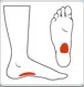 icon showing location for typical plantar fascities pain